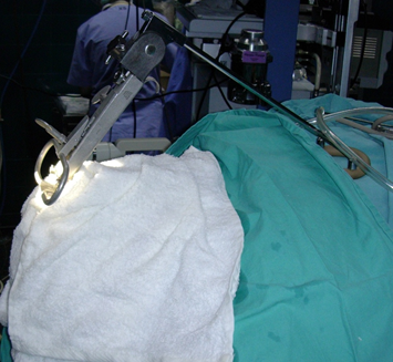 Larenks cerrahisinde lazer uygulamaları için geliştirilmiş larengoskoplar görülmektedir.